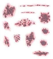 Scabs Tattoos