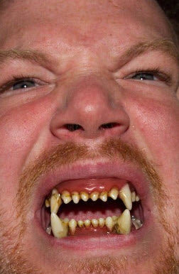 Teeth FX - Image 4